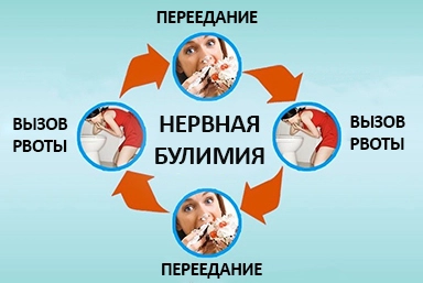 Лечение булимии в Свердлово
